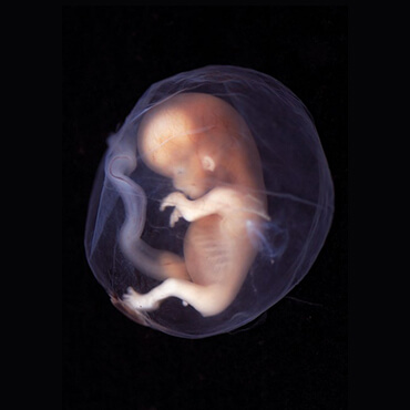 Abortus